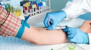 fumer et faire un test sanguin dans une veine